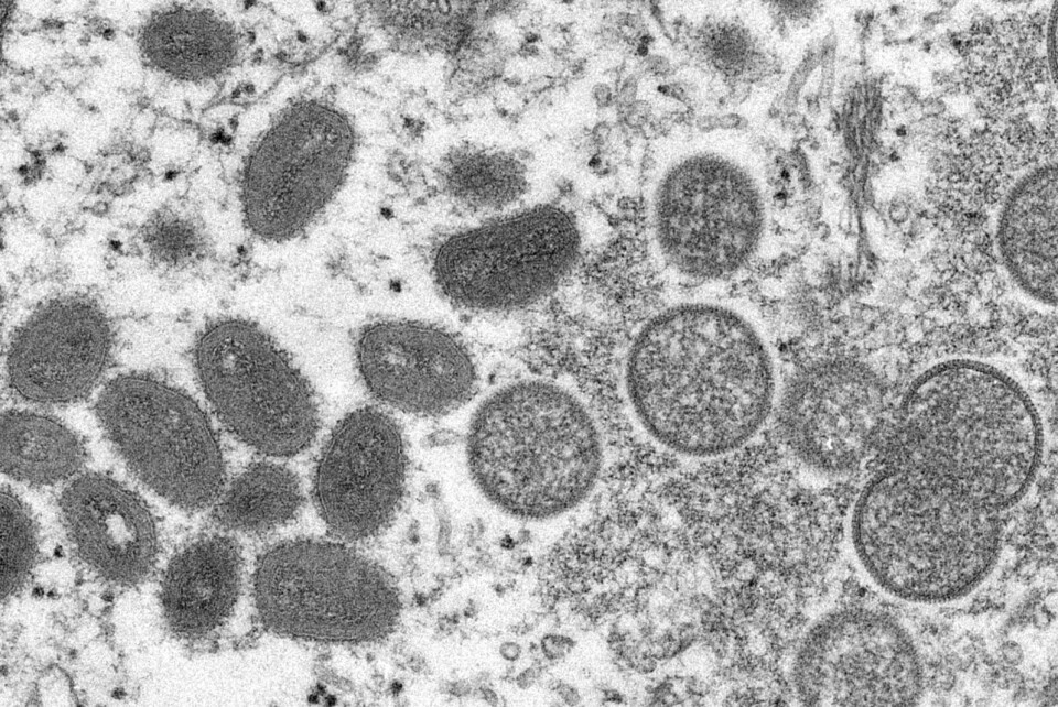 VIRUS: Dette mikroskop-bildet viser forskjellige typer apekopp-virus. Foto: Cynthia S. Goldsmith / Russell Regner / CDC / AP / NTB