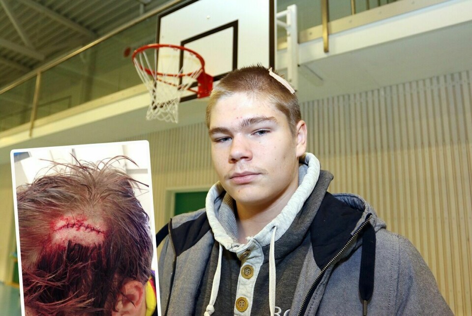 FIKK STATIV I HODET: Ben-Jøran Lieng måtte i forrige uke sy seks sting i etter at et basketstativ løsnet fra veggen og traff han på venstresida av hodet. Foto: Ivar Løvland